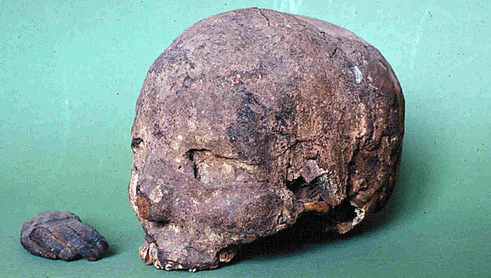 Head of a mummy